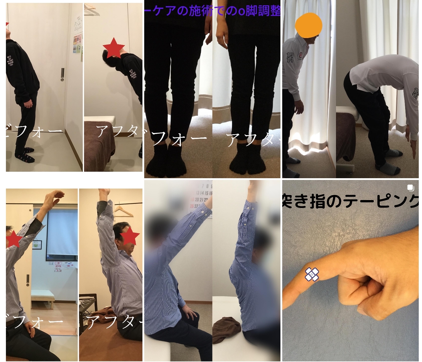 ビフォーアフター画像2